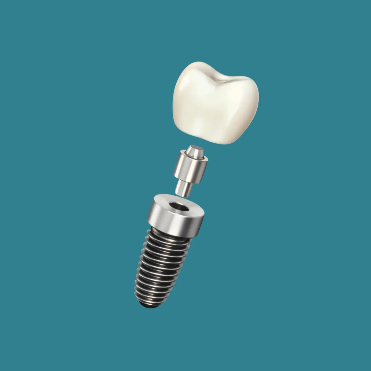 Implant Restorations