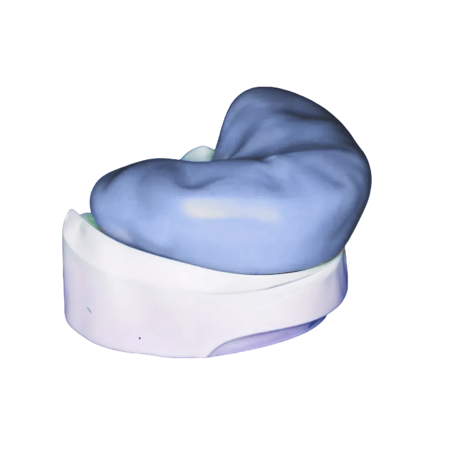 Putty Stent for Trial Smile